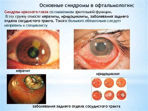 Уникальный прорыв в восстановлении зрительной функции