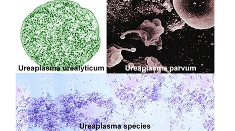 Уреаплазма: что это и как она возникает?