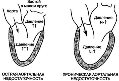 Усиленное пульсирование