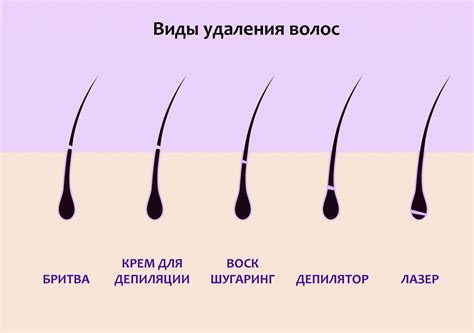 Устранение проблем с вросшими волосами