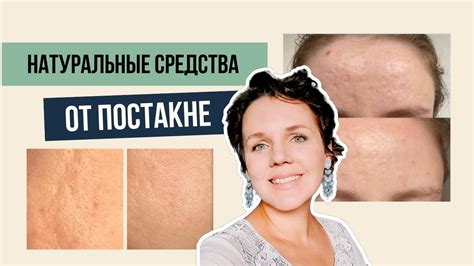 Устраняем следы от косметики: эффективные средства и трюки