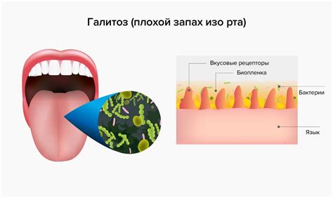 Устраняет неприятный запах изо рта