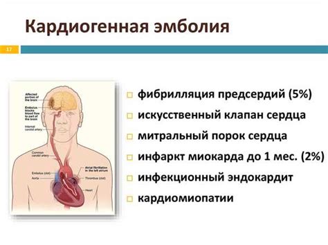 Уточненные поражения сосудов мозга: симптомы и лечение