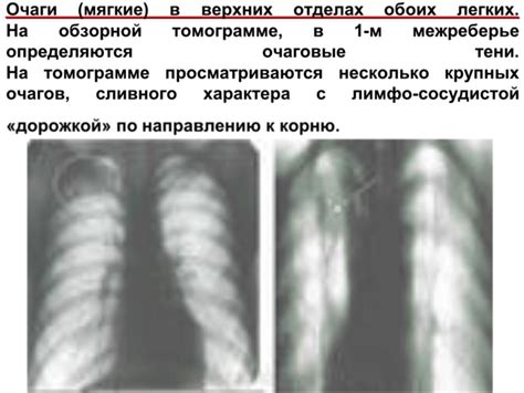 Факторы, способствующие появлению очагов сливного характера в легких