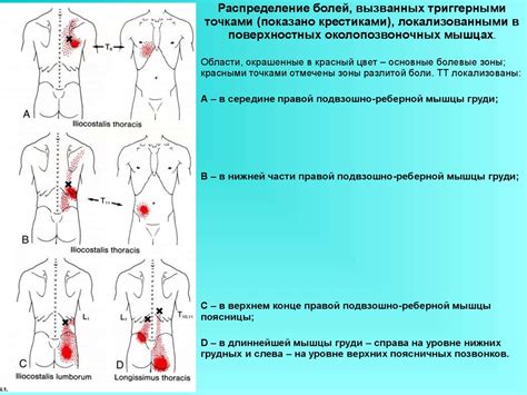 Физиология триггерных точек в организме человека