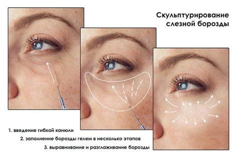 Физические методы лечения носослезной борозды