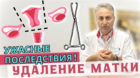 Физические последствия удаления матки