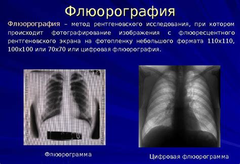 Флюорография в Чайковском: доступная диагностика