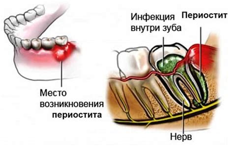 Флюс: что это и как его распознать