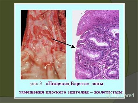 Функции и значение клеток многослойного плоского неороговевающего эпителия