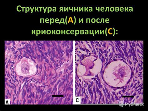 Функция яичника перед операцией