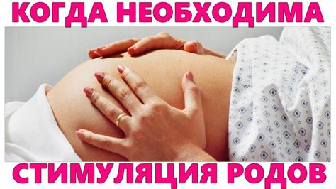 Химическая стимуляция родов