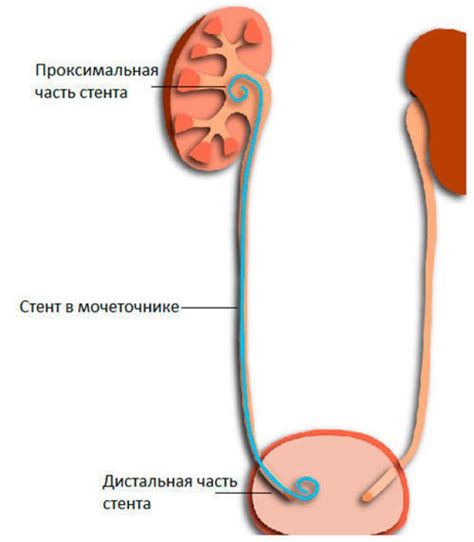 Частые мочевые проблемы