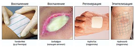 Чем опасна открытая рана от ожога и что делать в первую очередь