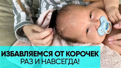 Чем опасны корочки на голове ребенка