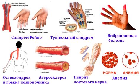 Чесание правой руки и ноги как признак аллергии