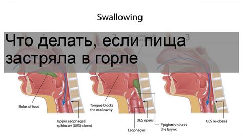 Что делать, если мошка застряла в горле?