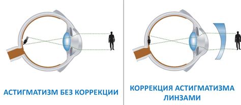 Что делать с засохшими линзами для глаз: 6 простых рекомендаций