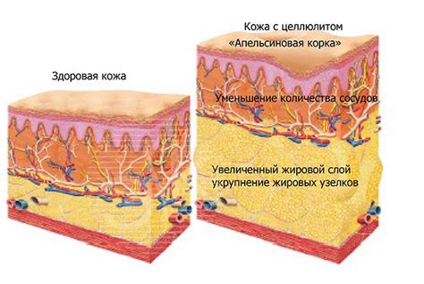 Что может спровоцировать появление фибромы на легком