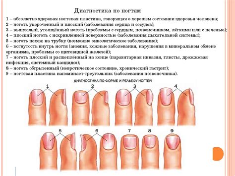 Что означают сновидения о красивых ногтях на руках?