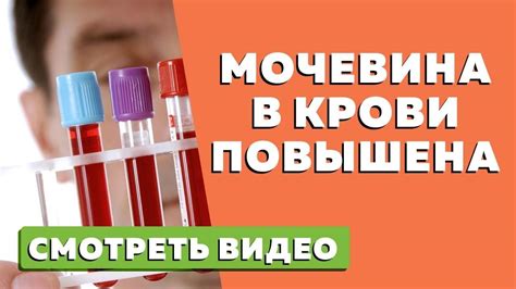 Что определяет креатинин и мочевина в крови