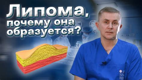 Что такое гарь и почему она образуется