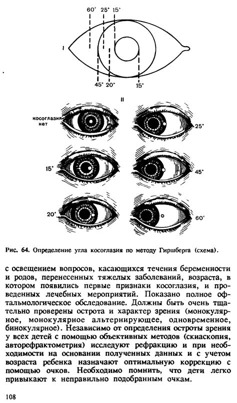 Что такое девиация по Гиршбергу угол 0?