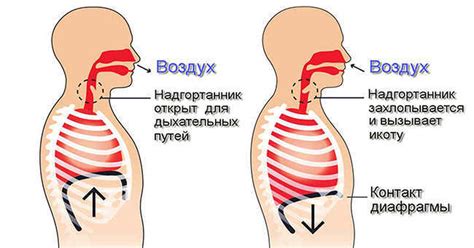 Что такое икота у собаки и как она происходит