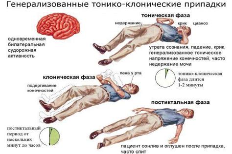 Что такое клонические судороги