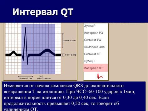 Что такое корригированный интервал QT?