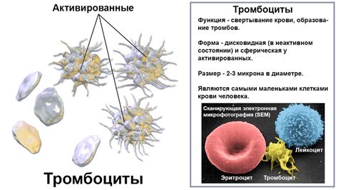 Что такое микроциты и почему они могут быть повышены в крови