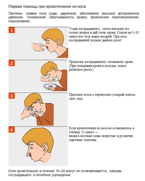 Шаги по остановке носового кровотечения