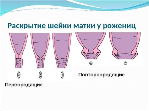 Шейка длинная на 40 неделе: безопасная родовая деятельность