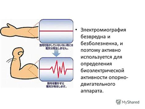 Электромиографический метод для измерения электрической активности мышц