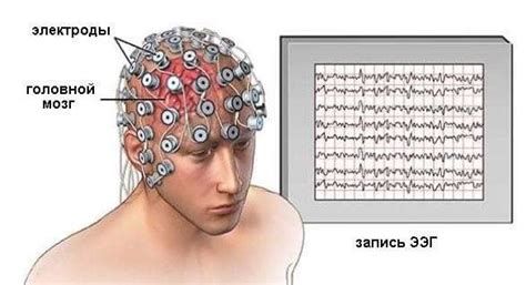 Электроэнцефалография: информация о кровообращении в мозге