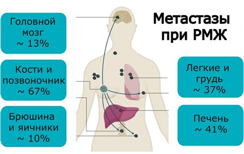 Этапы лечения при легочном раке