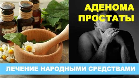 Эффективные народные рецепты для лечения кальцинатов в простате