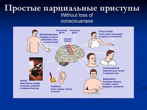 Эффекты эпилептических припадков на работу мозга