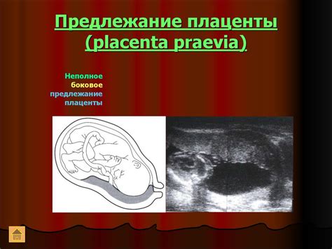 Язва на плаценте во время беременности: причины и лечение