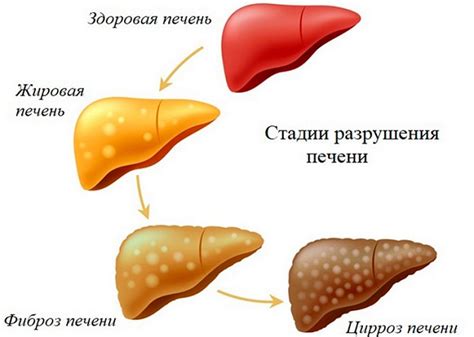  Как определить состояние печени: симптомы и анализы 