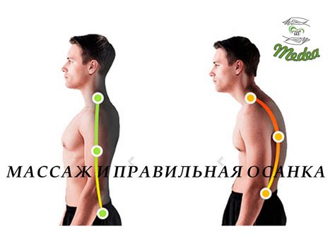  Правильная осанка: ключ к избавлению от горба 