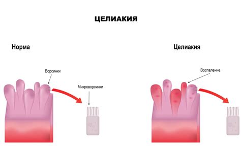  Симптомы и диагностика 